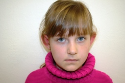 Monika před operací
