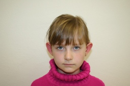 Monika před operací 2. fotka